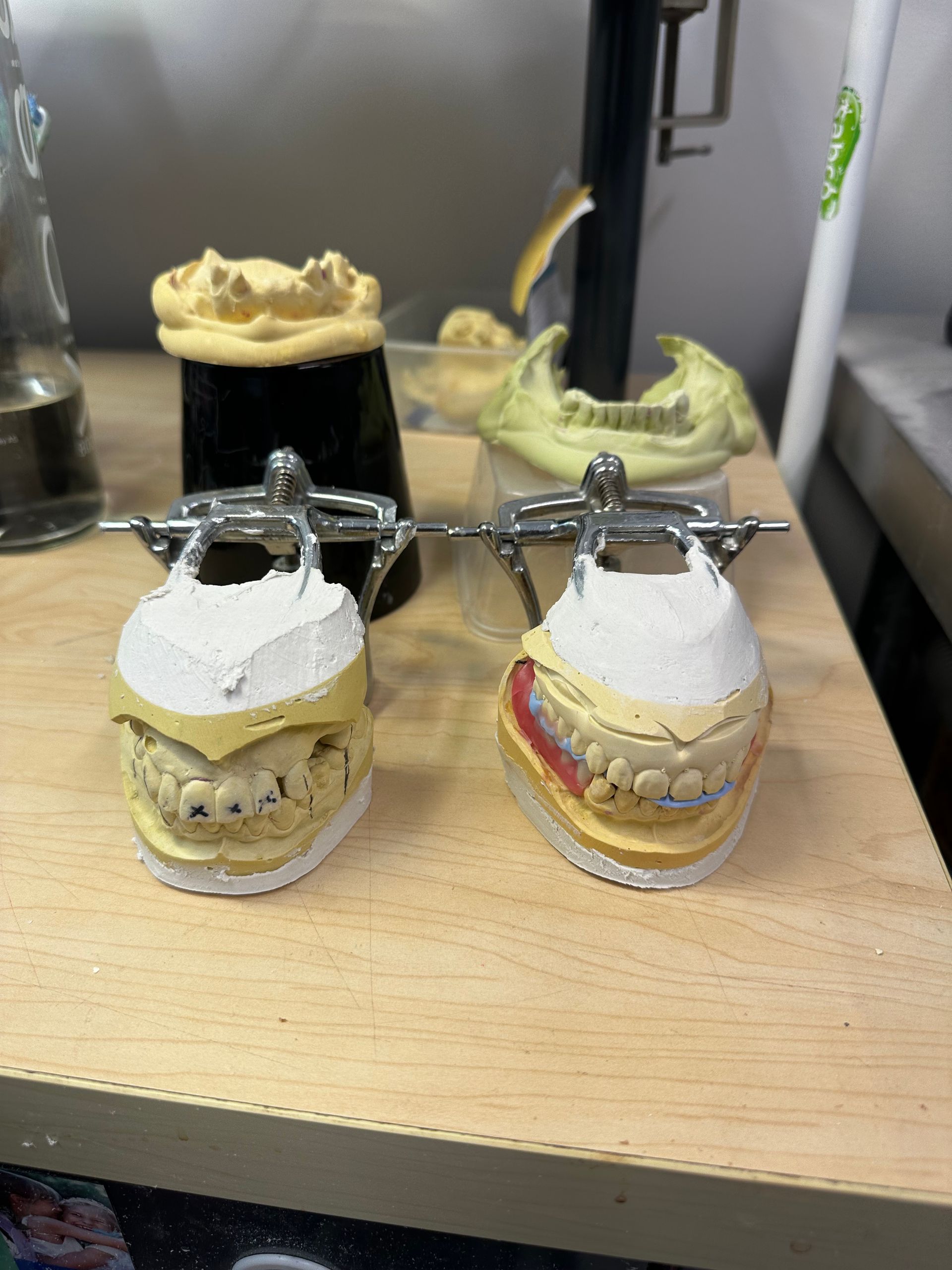 Two dental molds with teeth in metal holders on a wooden surface. Two other molds are in the background.