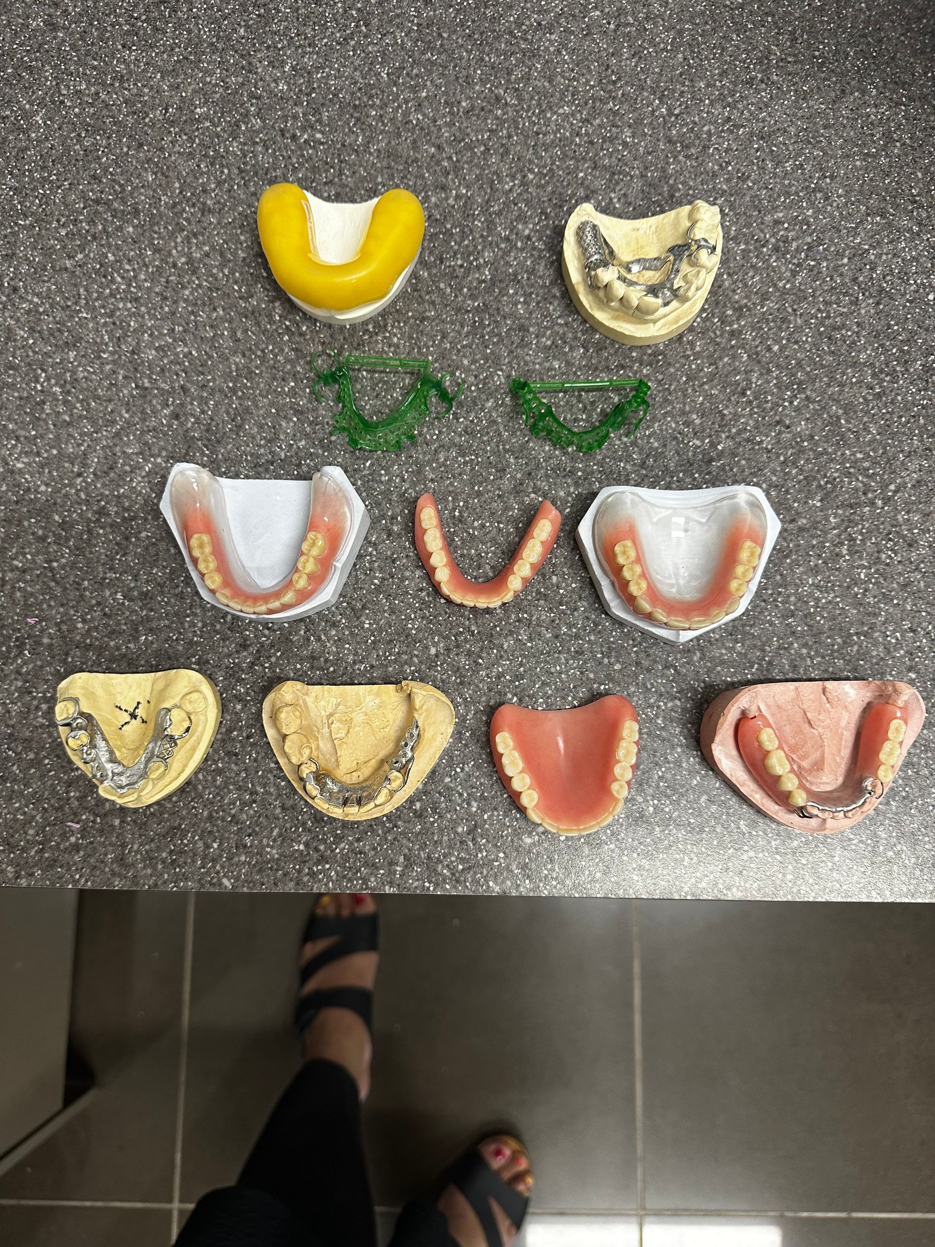 Various dental molds and dentures on a gray surface. A person's feet in sandals are in the foreground.