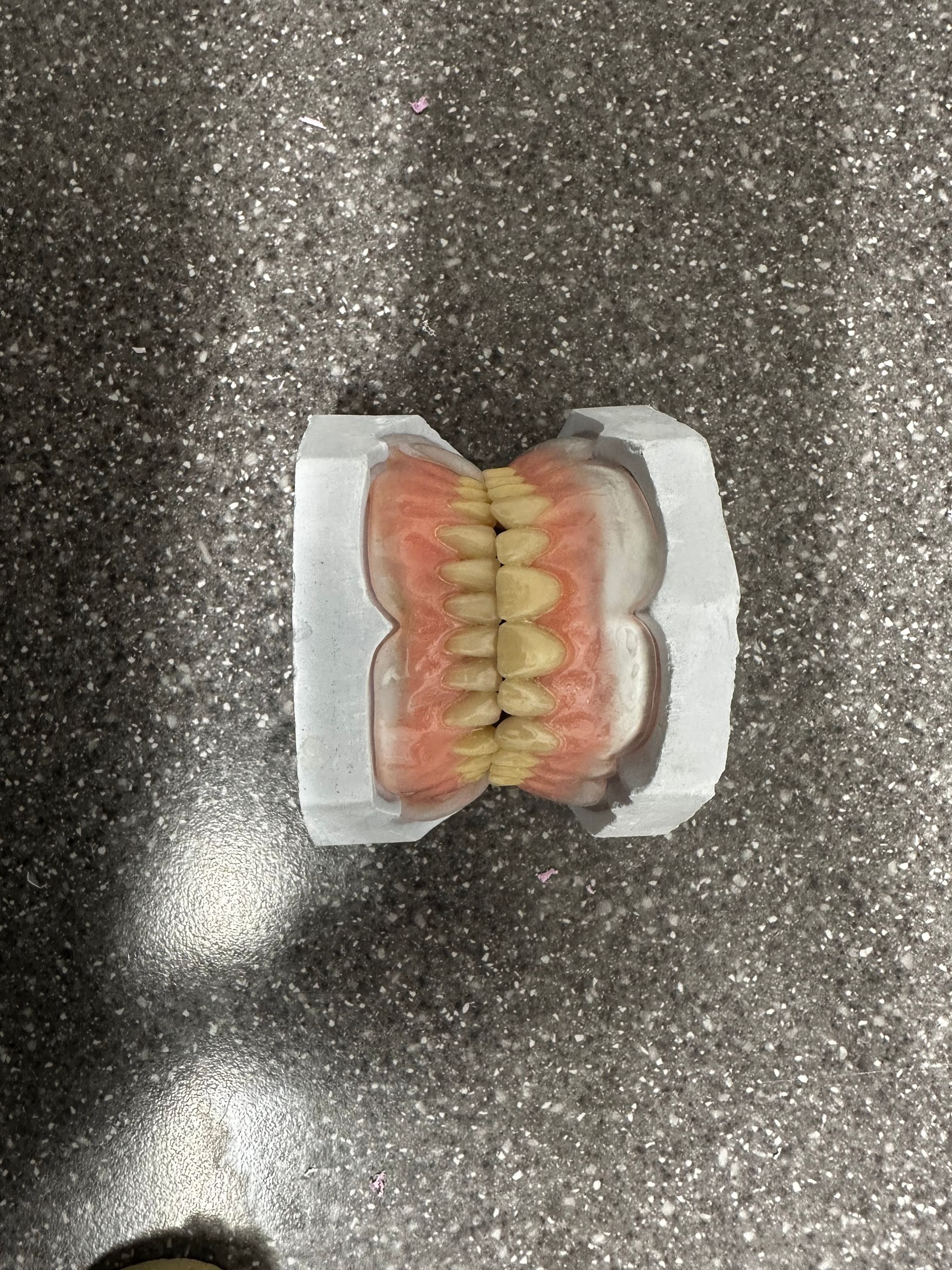 Upper and lower dentures, with pink gums and yellow teeth, inside a white protective holder, resting on a gray surface.