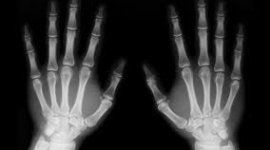 radiologia mani