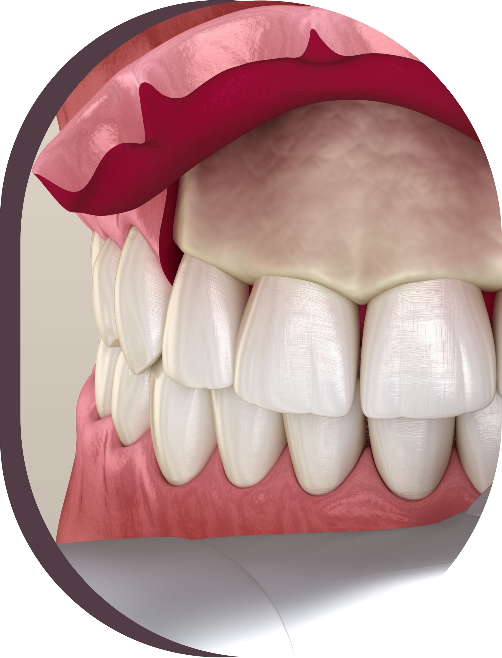 A close up of a mouth with teeth and gums