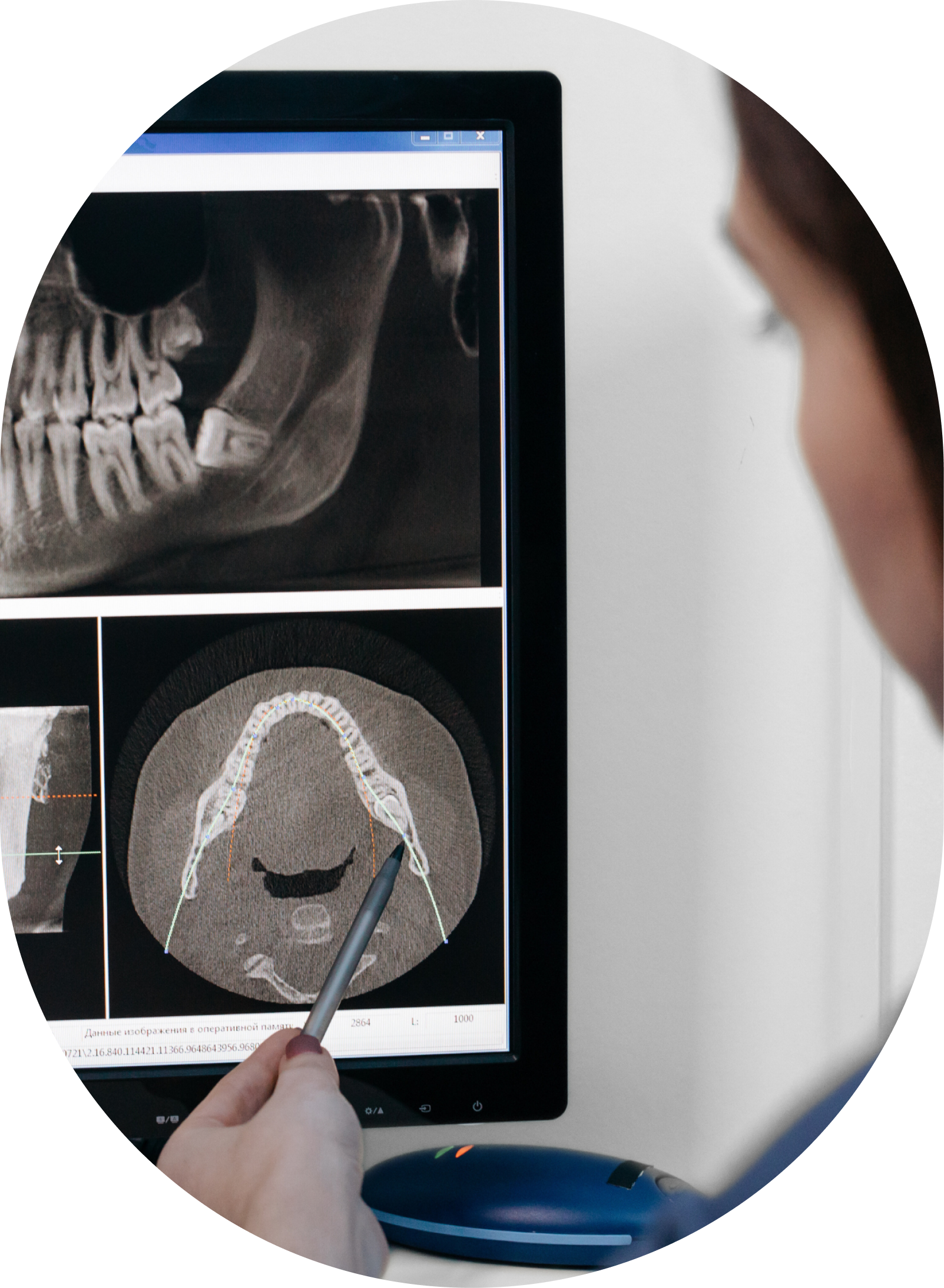 A dentist is looking at an x-ray of a person 's teeth on a computer screen.