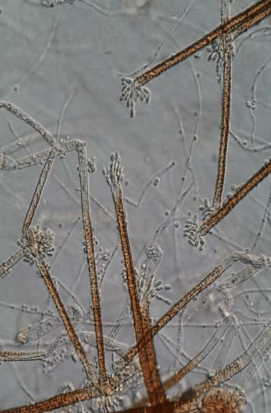 a close up of a microscope image of a plant