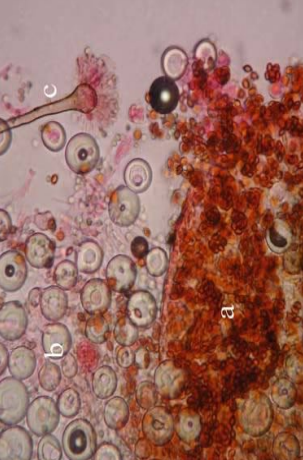 a close up of a mushroom under a microscope .