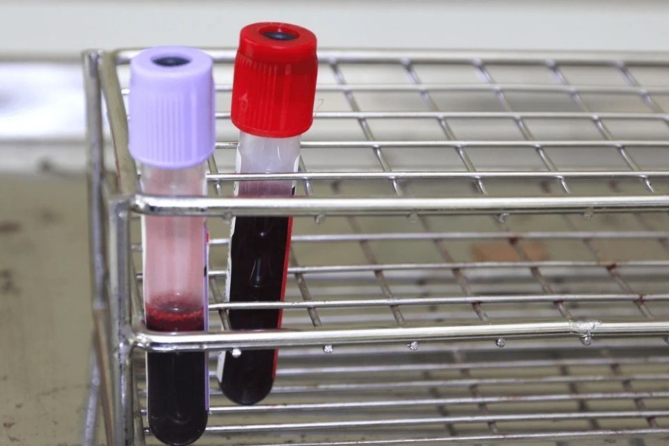 provette nel laboratorio di analisi