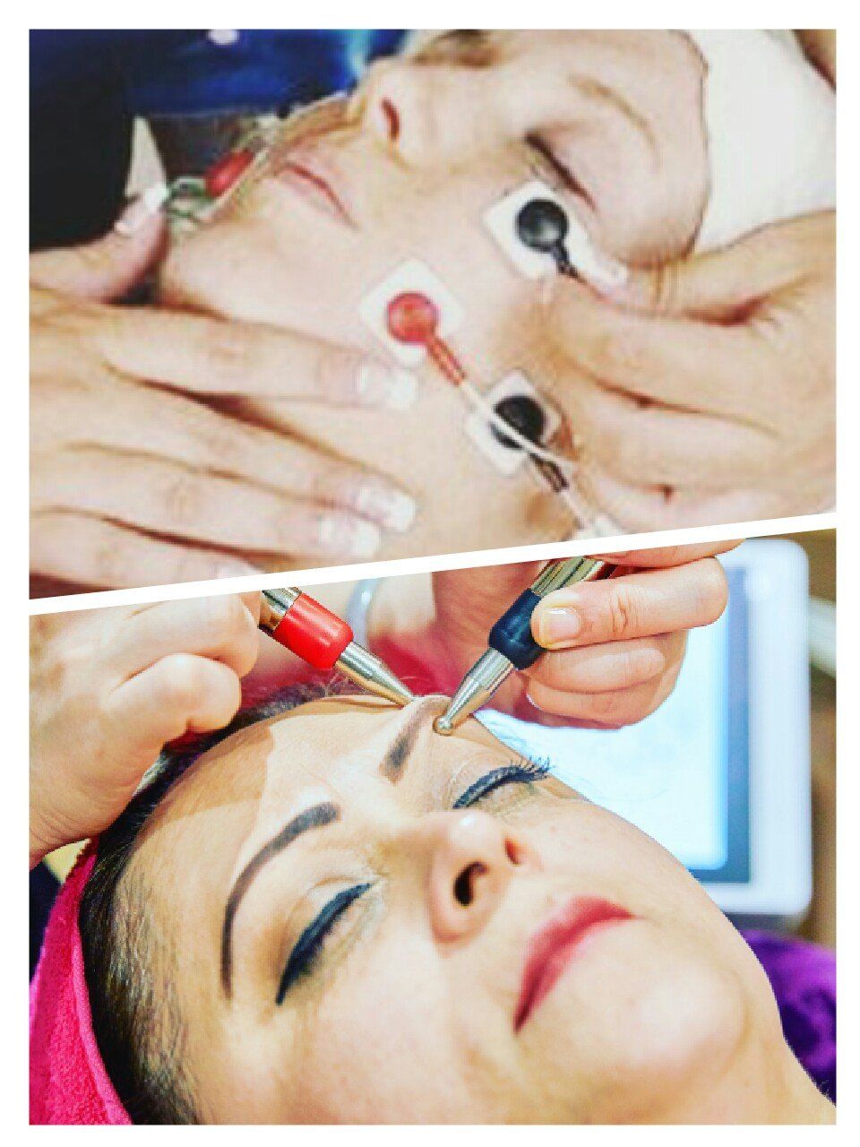 face lifting microcurrent