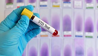 STD test in Brazil