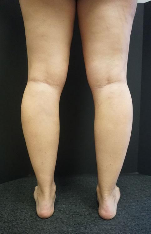 A woman 's legs are shown with a black background.