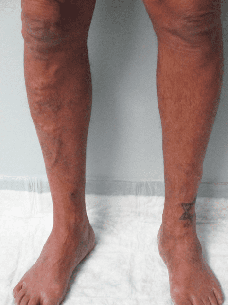 A close up of a person 's legs and feet on a white towel.