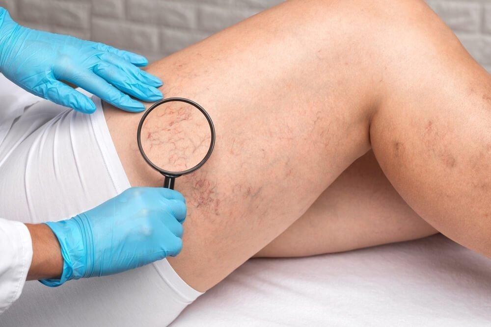 A doctor is examining a woman 's leg with a magnifying glass.