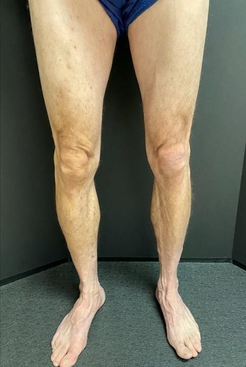 A man in blue underwear is standing with his legs crossed.