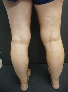A woman 's legs are shown in a close up.