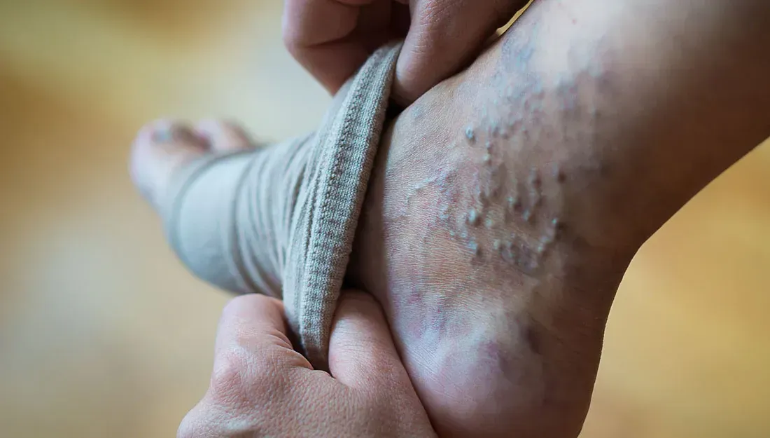 A person is putting a bandage on their leg.