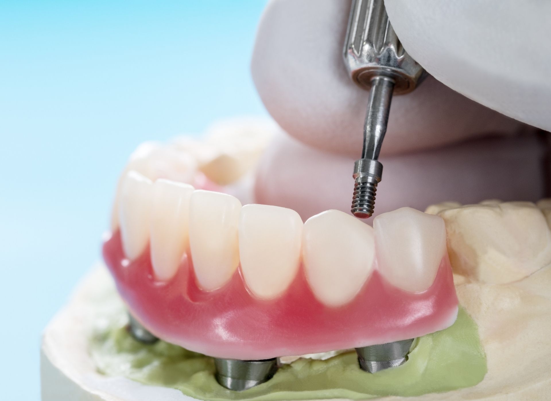 Dentist drills into a dental implant model with a set of new teeth attached.