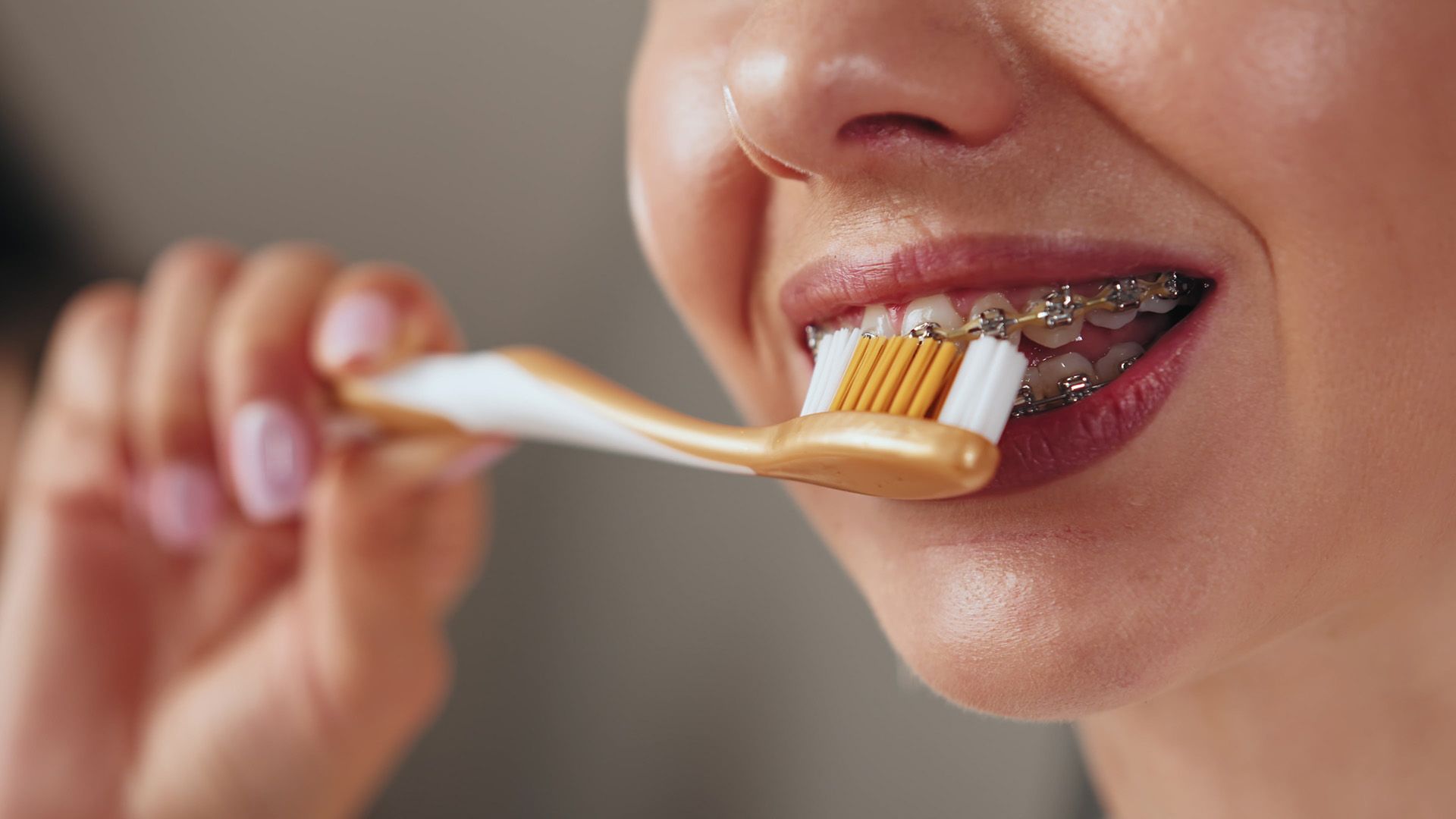 Can You Use Whitening Toothpaste with Braces?