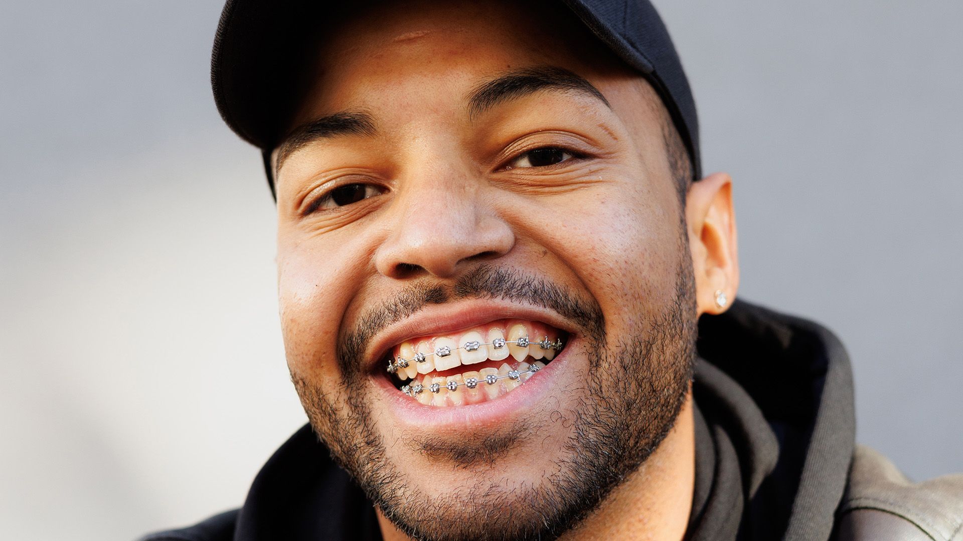 Can You Use Your HSA to Get Braces?