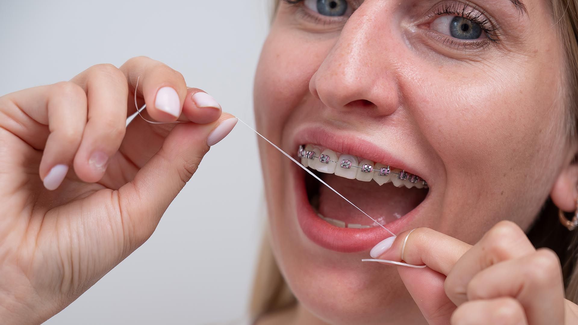How to floss with braces