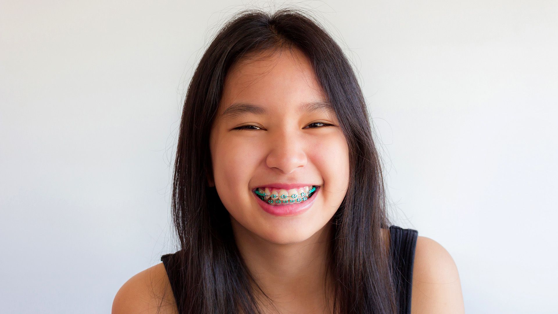 Latest braces for teeth, new braces and new types of braces