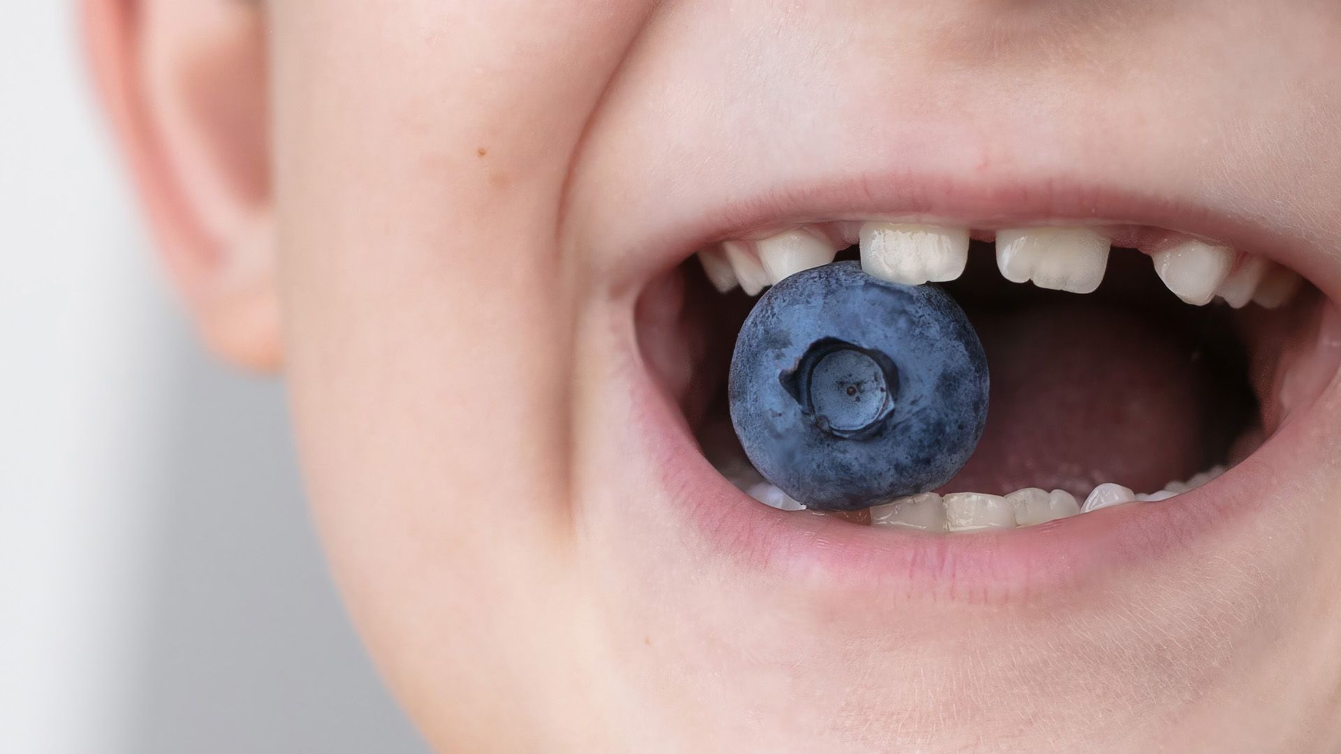 Understanding Spaces Between Teeth