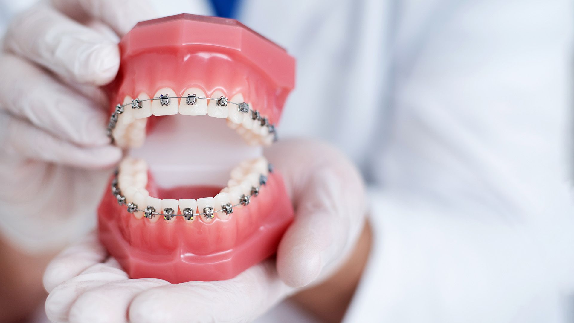 The Benefits of Straight Teeth