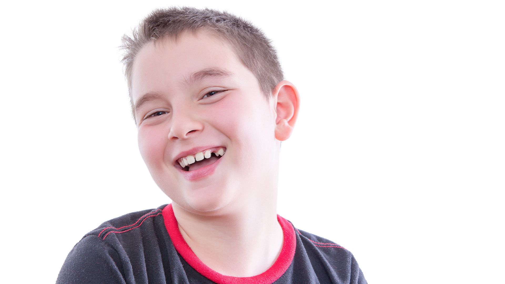 Can You Get Braces with Missing Teeth?