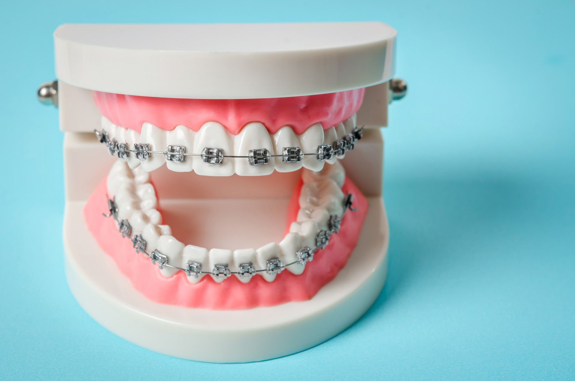 how early orthodontic screening can save money