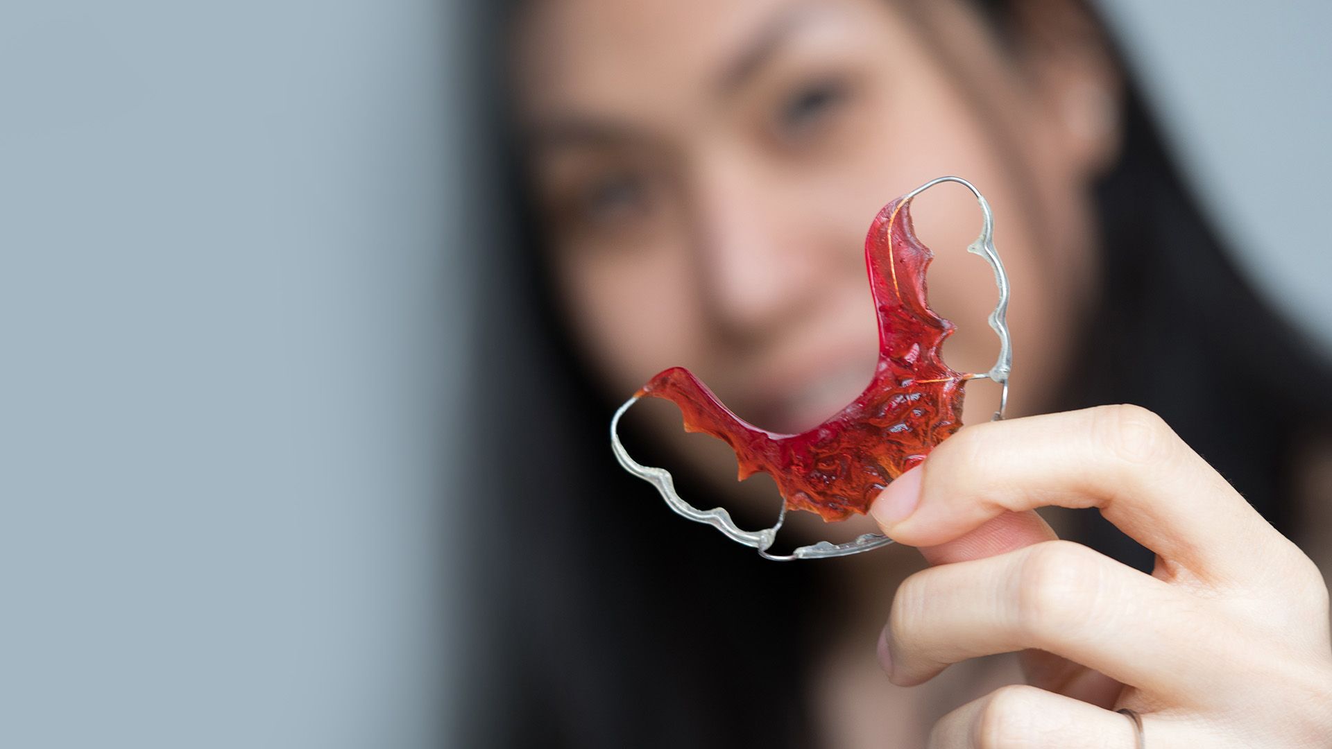 How Long Do You Need Retainers After Braces?