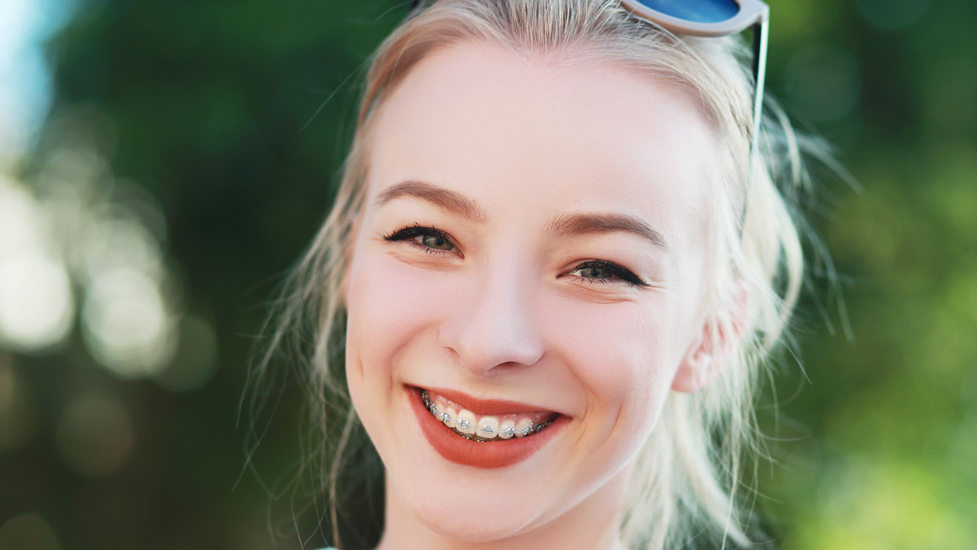 How Soon Can I Get Braces After Wisdom Teeth Removal?