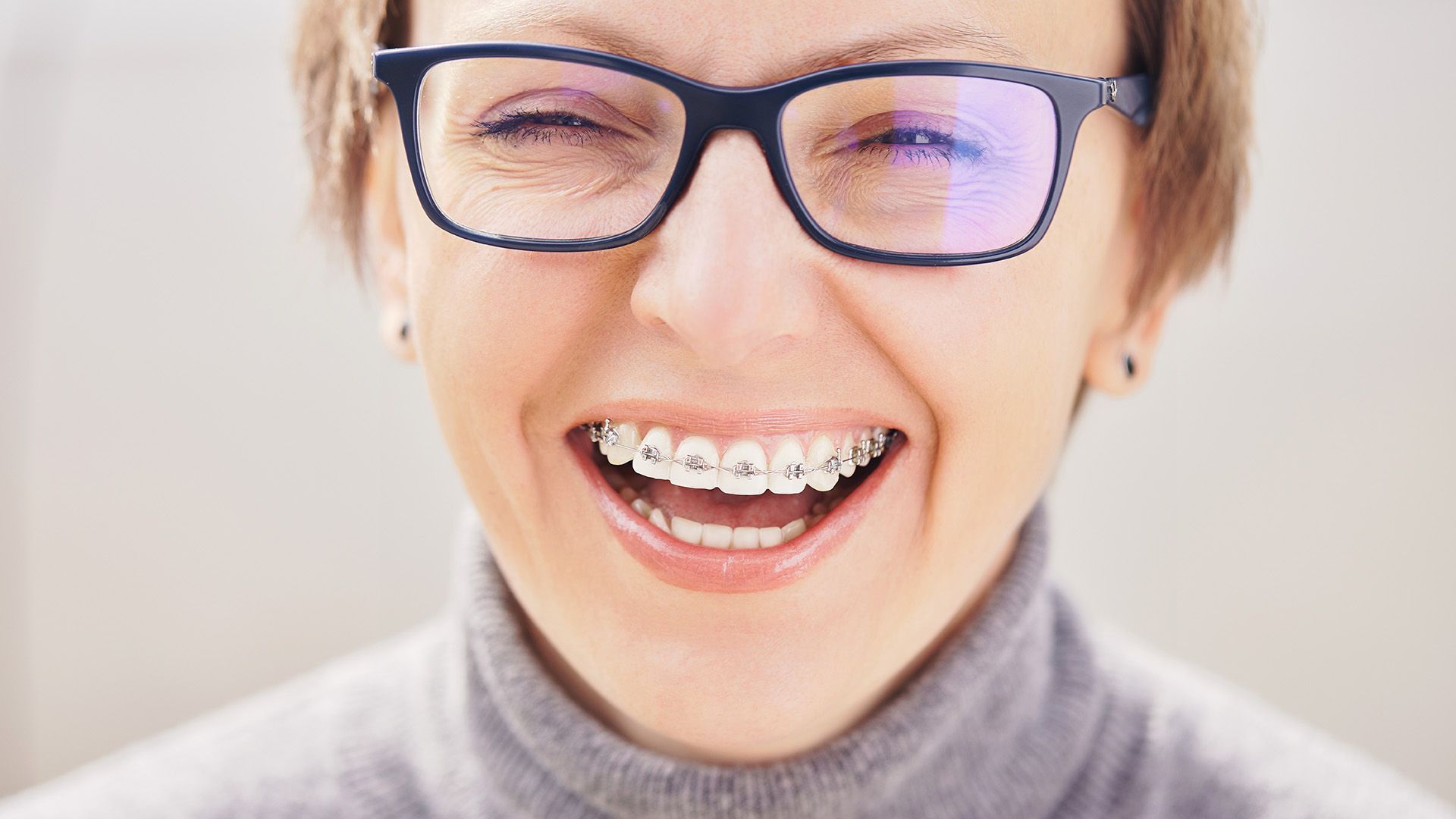 Is It Too Late to Get Braces if You're an Adult?