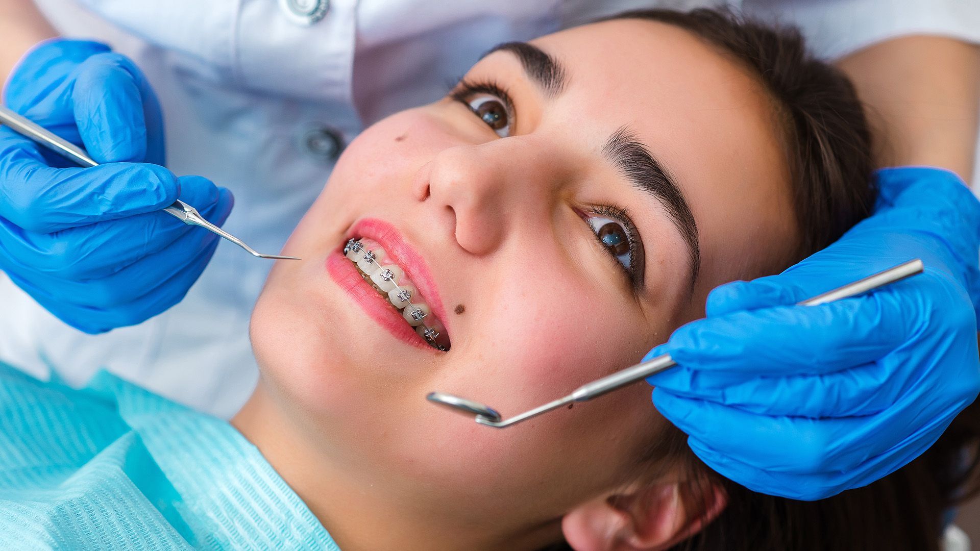 What to Know Before Getting Braces