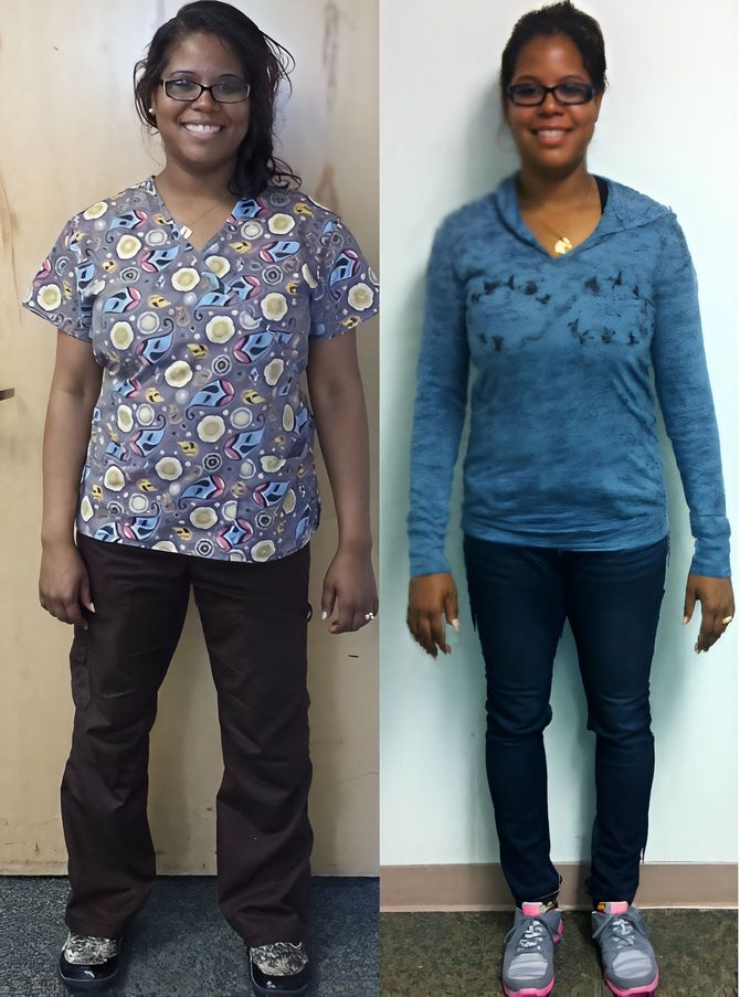 A before and after photo of a woman wearing scrubs and a blue shirt