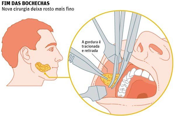 Theus Qfikedrrw ? = onde eu te beijaria: 1- boca. 2- pescoço. 3- bochecha.  4- mão. 5- sem