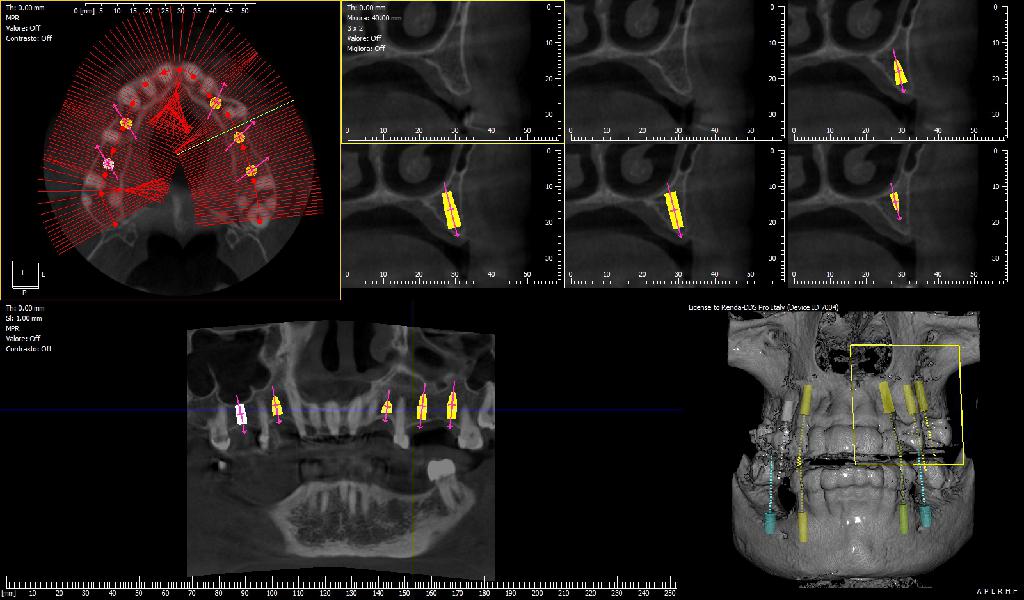 Risultato ortopanoramica dentale