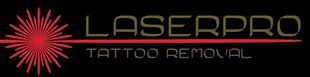 Laserpro Tattoo Removal: Removing Tattoos in Shellharbour