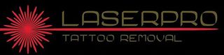 Laserpro Tattoo Removal: Removing Tattoos in Shellharbour