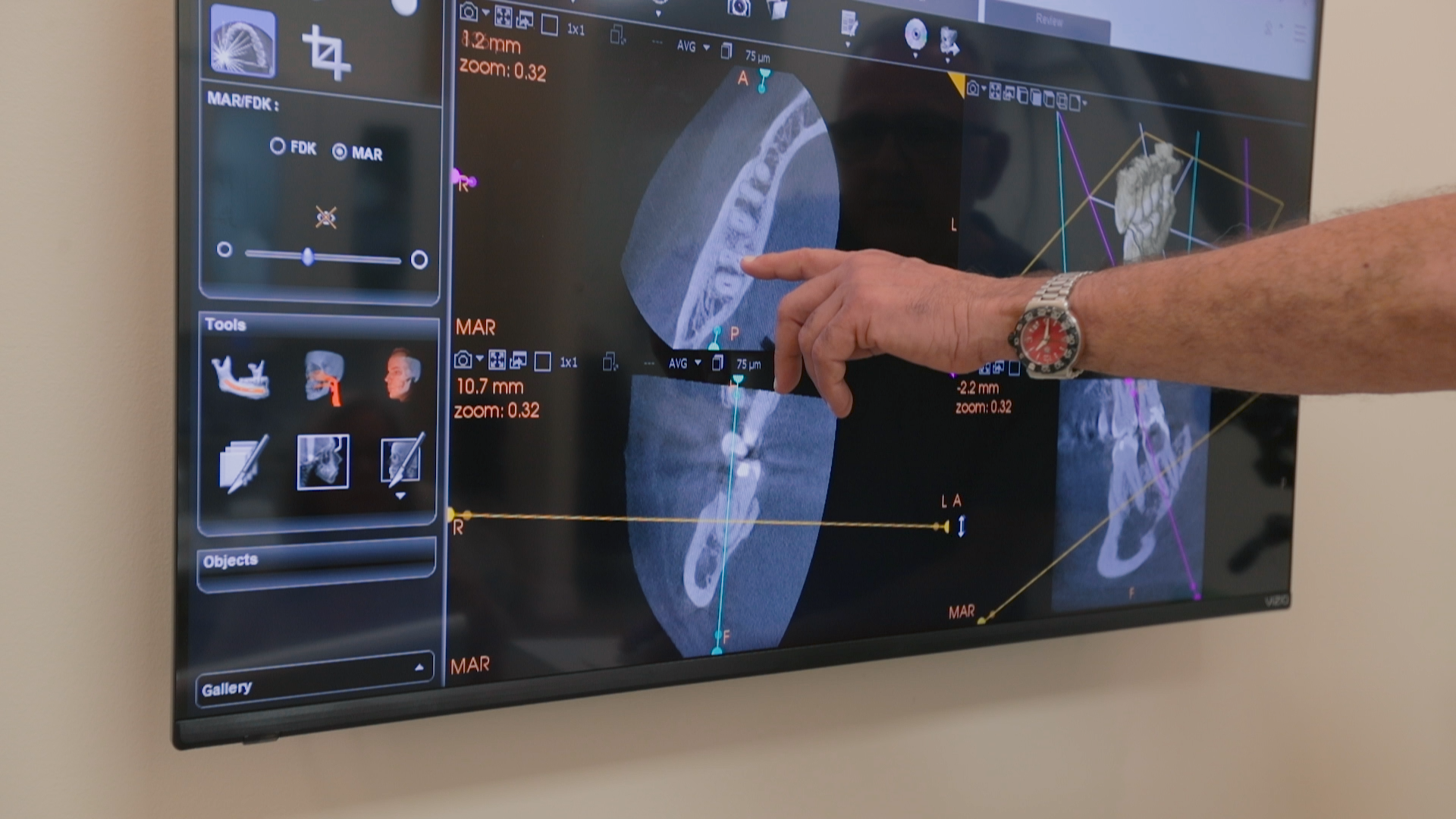 Preview thumbnail for advanced technology video