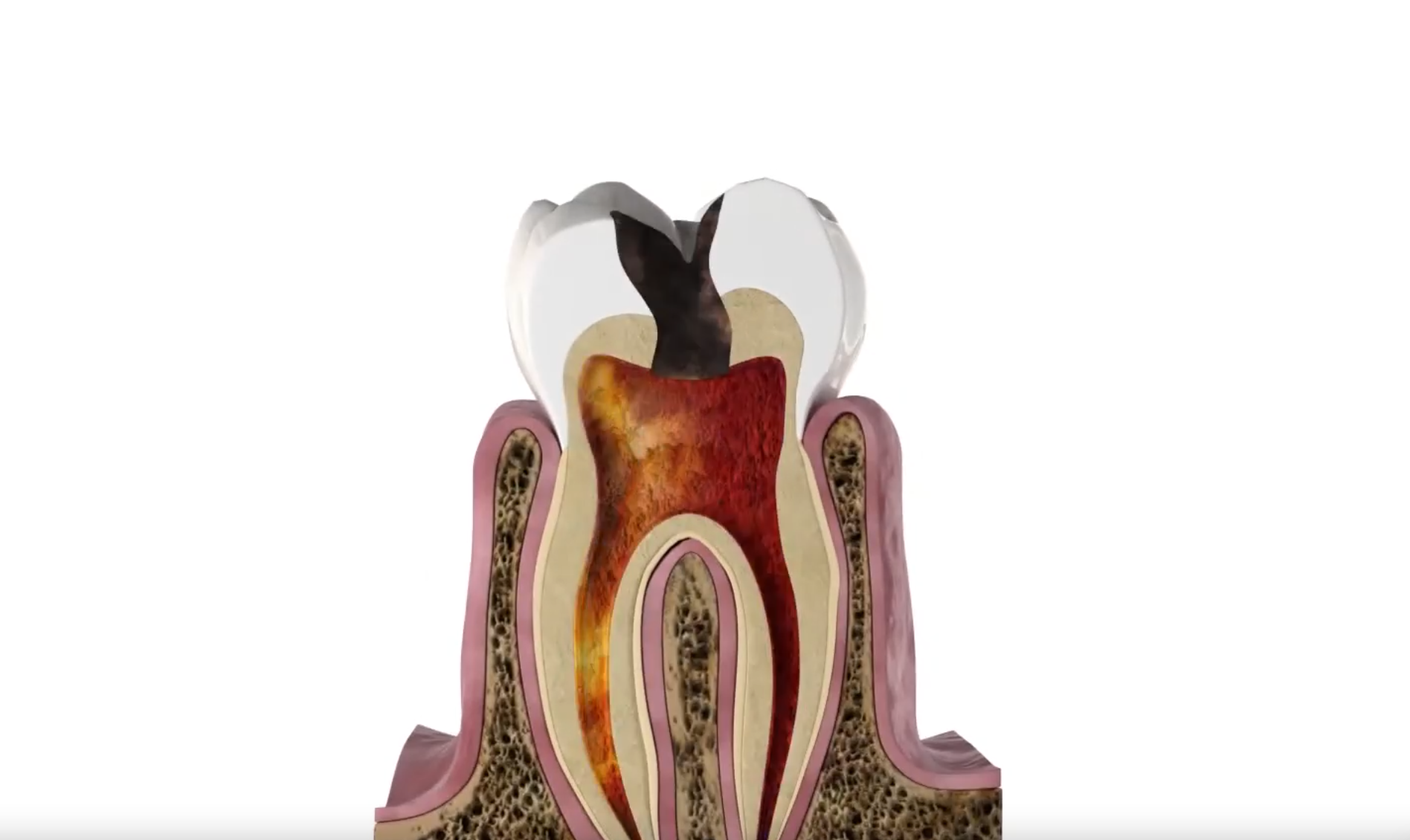 Fotona SWEEPS static thumbnail