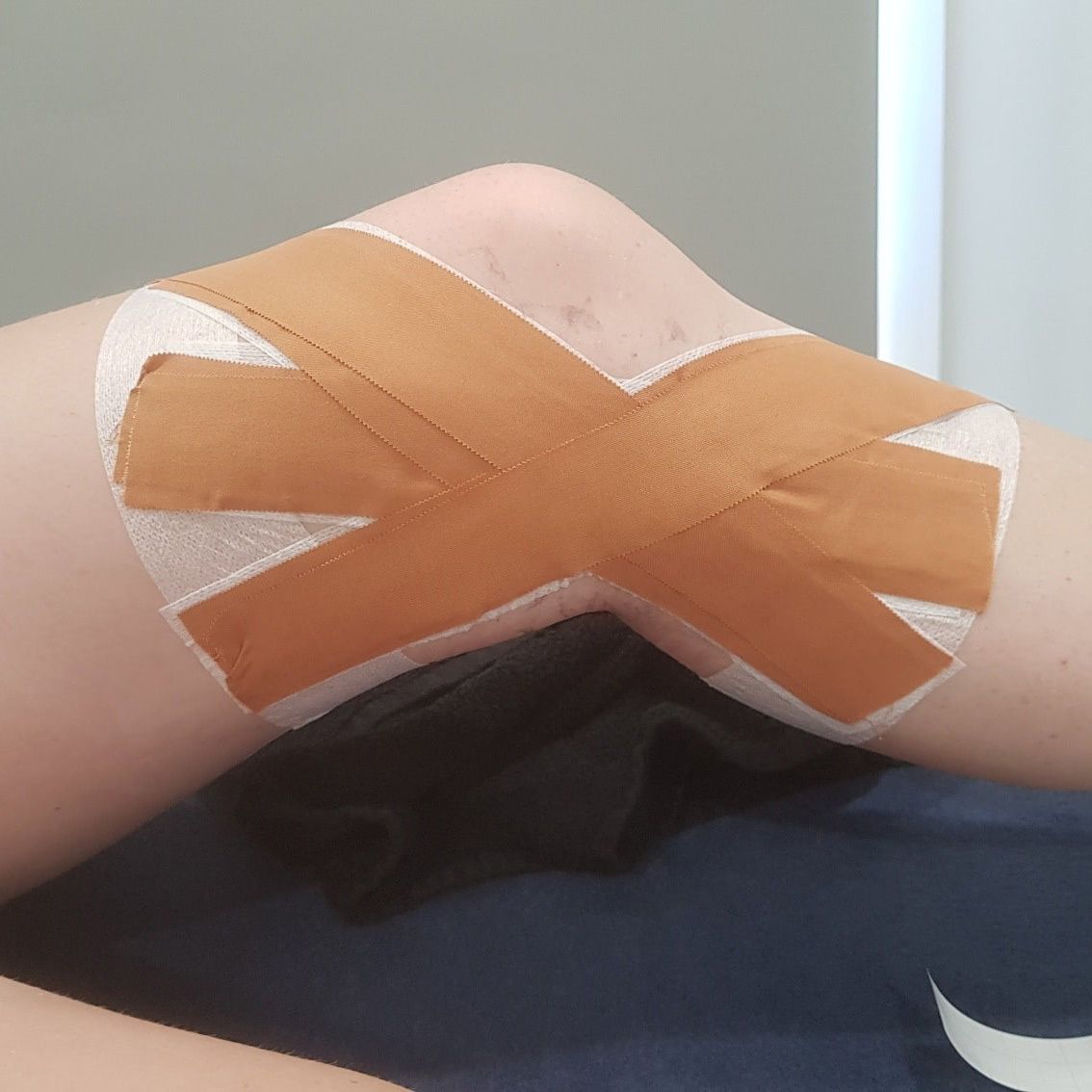 Person is Laying on a Bed With Knee With Brown Tapes — Return to Performance Physiotherapy In Epsom, VIC