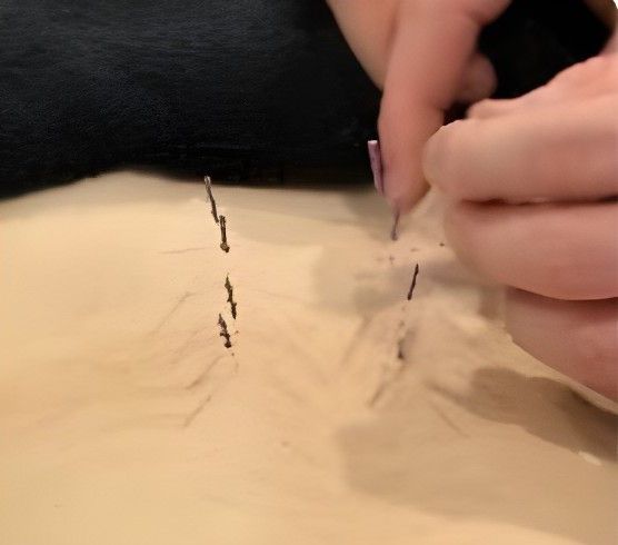 Hands placing pins into a light-colored, textured surface — Return to Performance Physiotherapy in Epsom, VIC