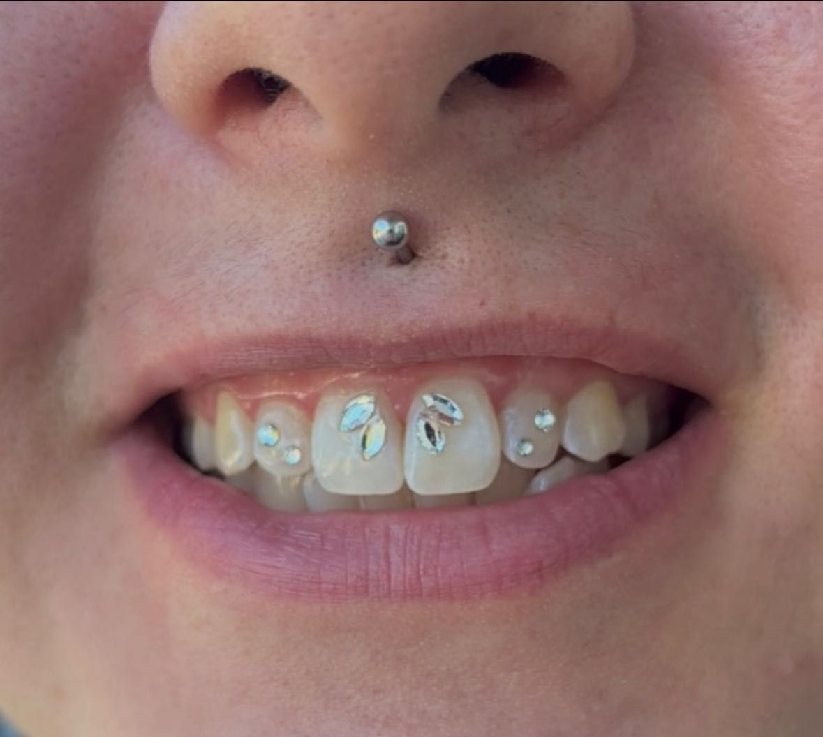 Close-up of a Person Smiling, Showing Teeth — Pins and Needles Tattoo in Kewarra Beach, QLD