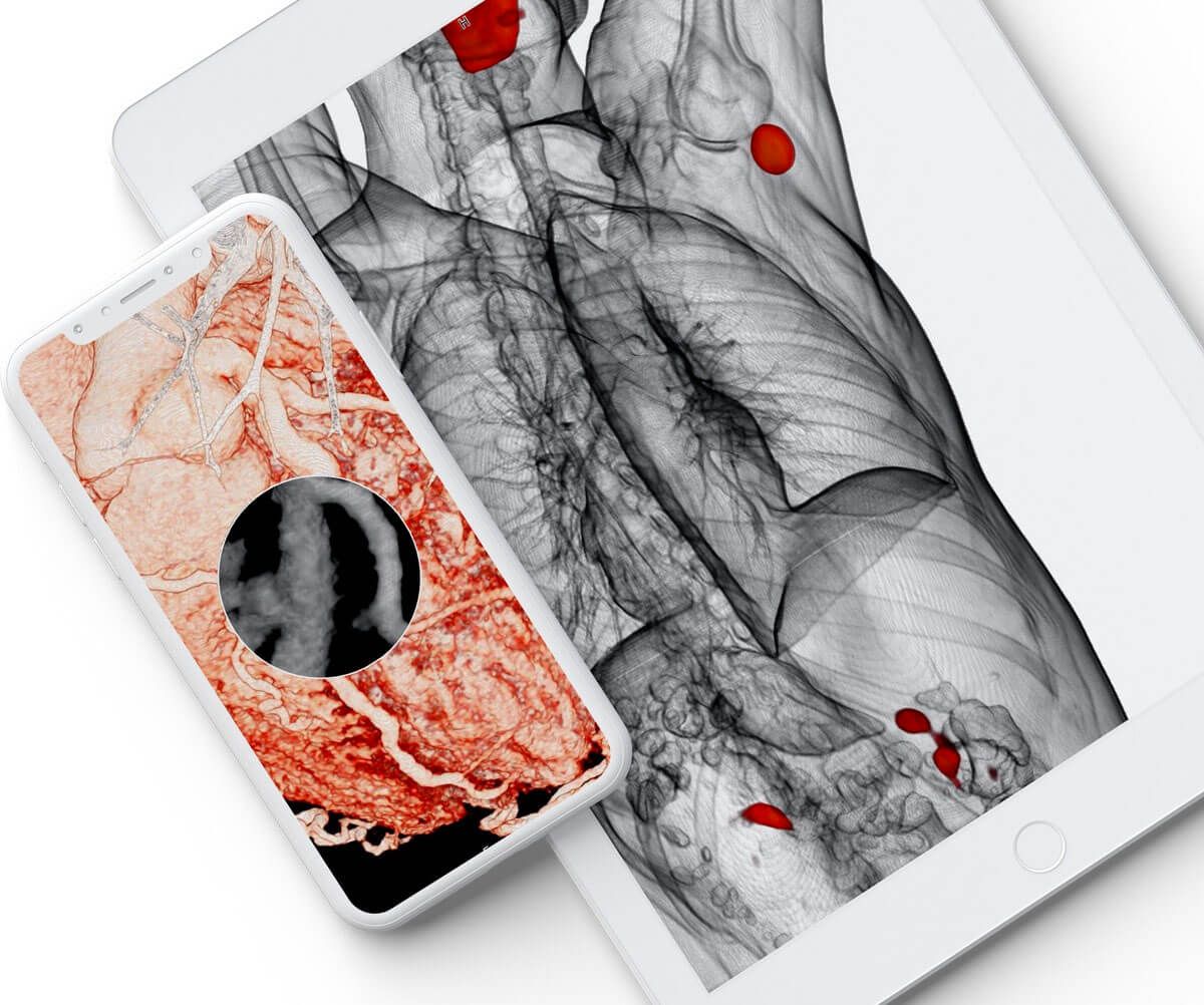 LifeVoxel Medical Imaging