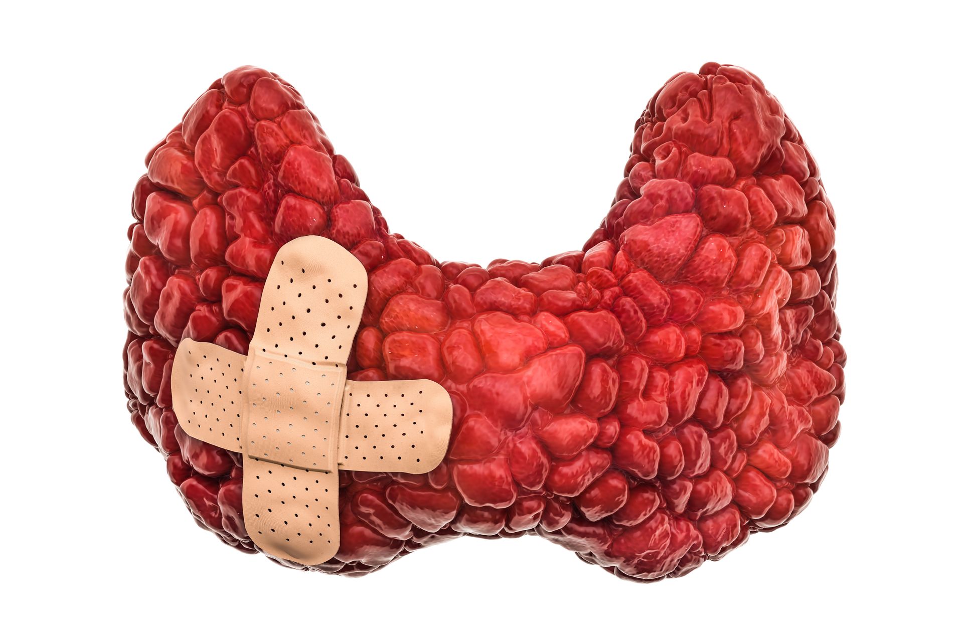 O que e bom para desmanchar nodulo na tireoide O que e bom para desmanchar nodulo na tireoide