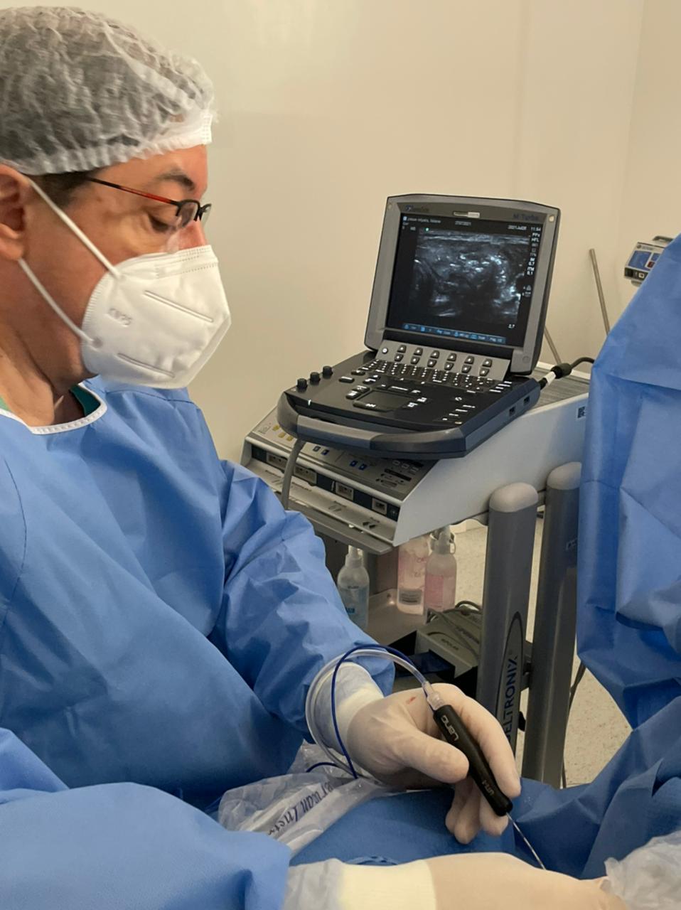 Quanto tempo dura a Ablação por Radiofrequência de tireoide? Quanto tempo dura a Ablação por Radiofrequência de tireoide?