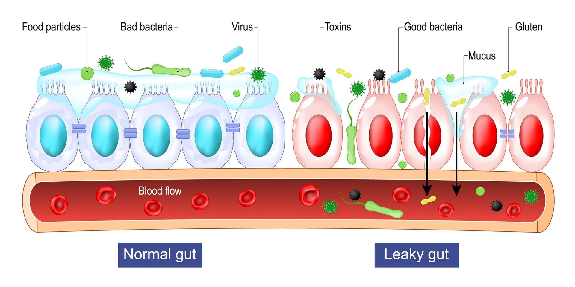 Leaky Gut Help - How To Identify, Heal, Rebuild, and Repair Your Leaky Gut