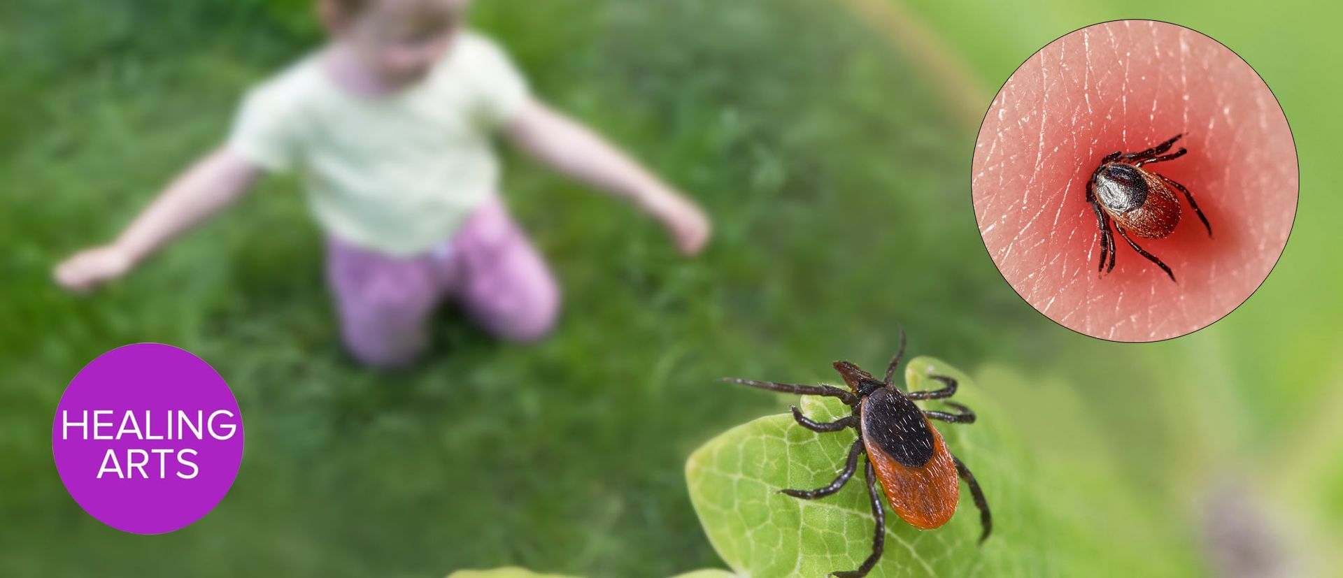 What You Should Know About Lyme Disease as the Season Approaches. Learn About Holistic Treatment for Lyme Disease and Tips for Prevention from Dr. Alicia Armitstead