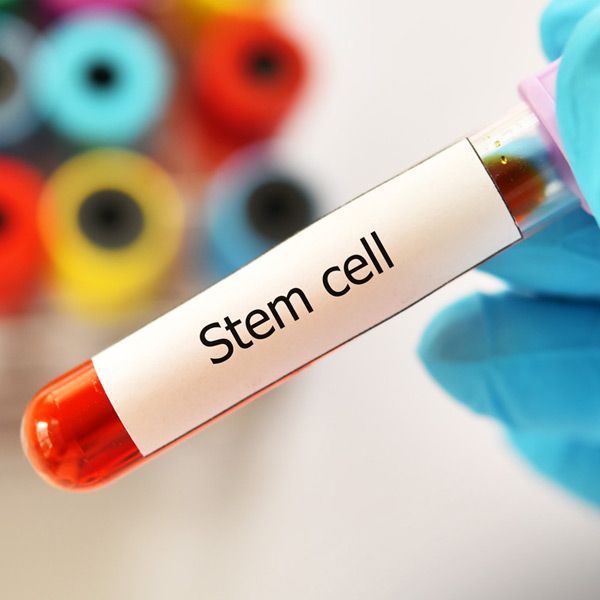 Stem Cell Therapy with Natural Supplements