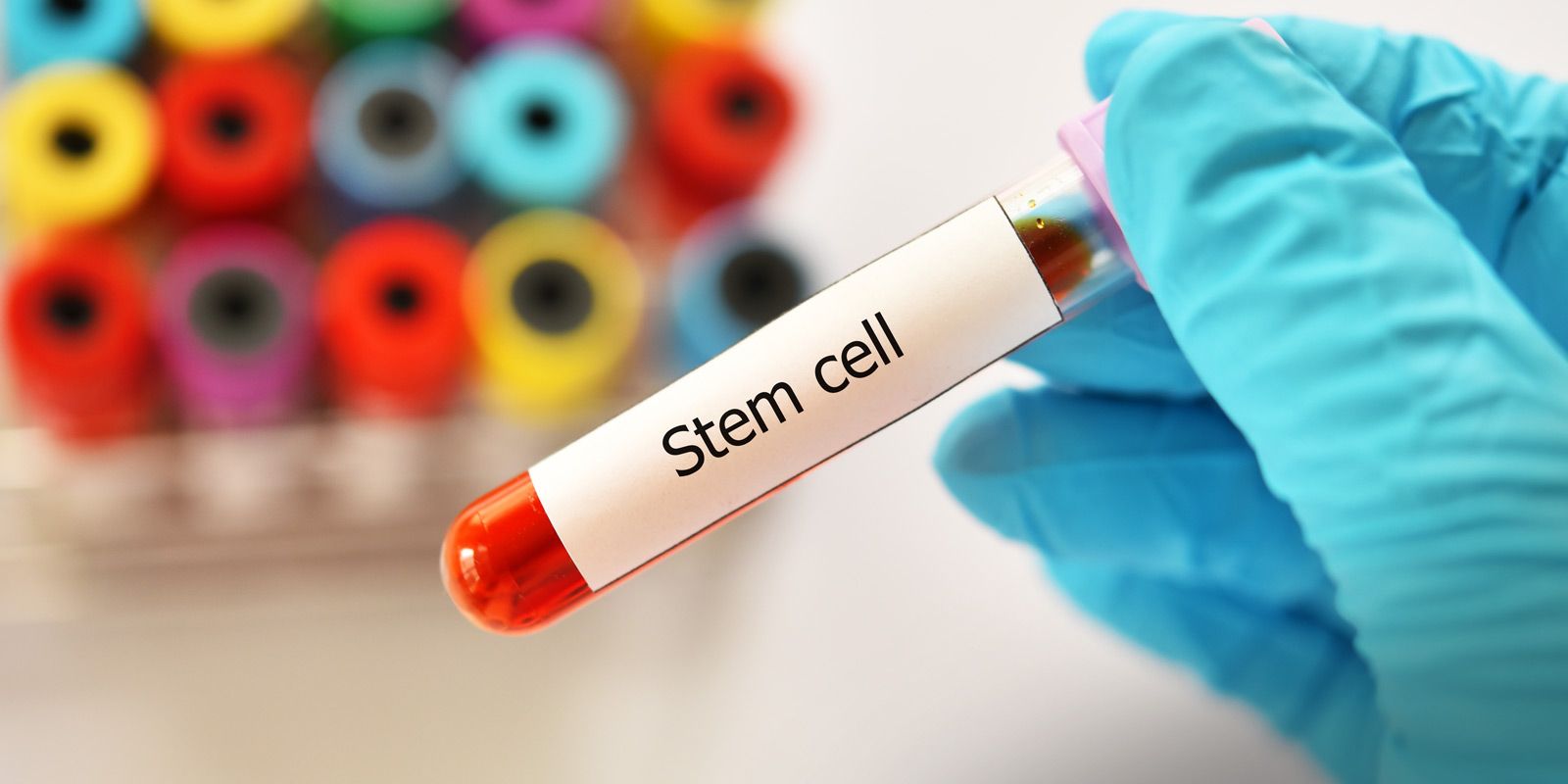 Stem Cell Therapy NYC by Dr. Alicia Armitstead. Natural Stem Cell Therapies at Healing Arts NYC Health and Wellness Center in Manhattan NY, 10017