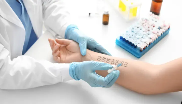A doctor is giving a patient an allergy test on their arm.