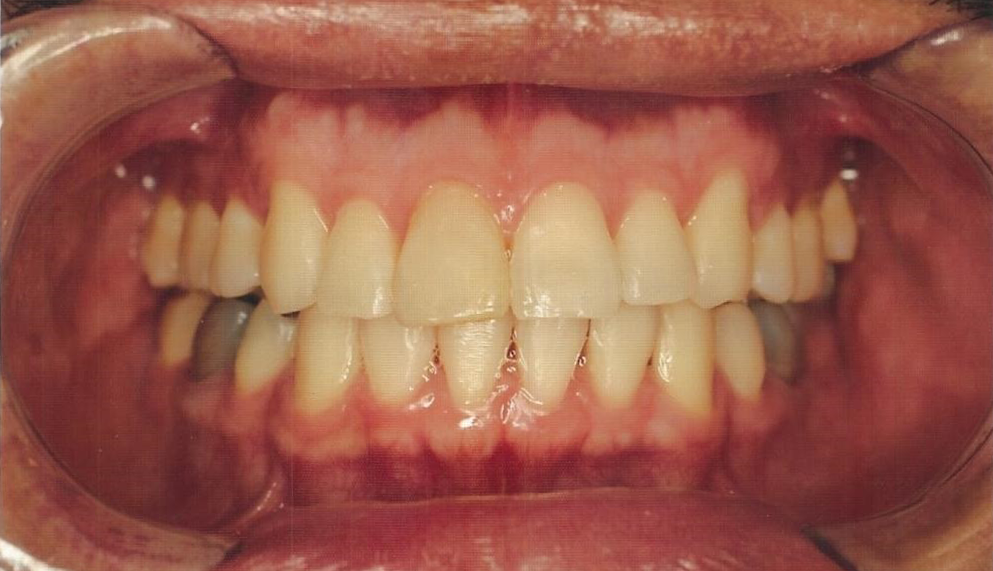 Before Image