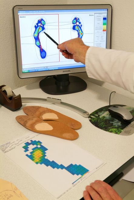 Un professionista indica un'analisi della pressione plantare sullo schermo di un computer, con delle solette ortopediche personalizzate sulla scrivania.